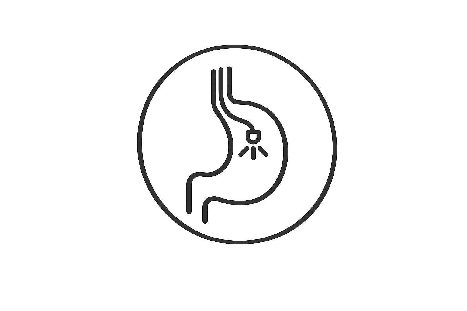 Upper GI Endoscopy (OGD)